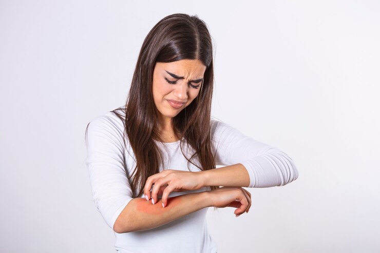 Skin Allergies